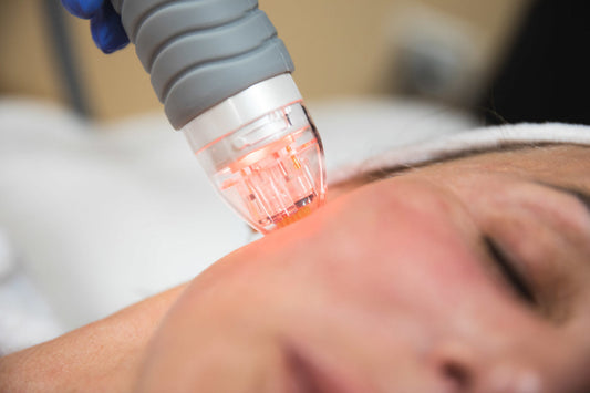 Microneedling: The Science, Benefits, and Why It's a Game-Changer for Skin Rejuvenation